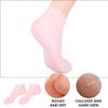 1 Pair Sock Lotion Foot Moisturizer for Dry Feet Moisturizing Heel Sleeves Retention Moisturizing Booties Moisturing Foot Silicone Gel Skin Protect Soles Miss Spa Short Boots Sebs view 4