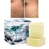ONIYEA 2 PK Sea Salt Soap 3.5 Oz Each, Exfoliating Acne Deeply Clean Problem Skin, Natural Goat's Milk, All Skin Types, Face Wash Body Wash Skincare, Women Men Gift view 1