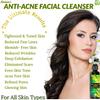Ammuri Anti-Acne & Anti-Ageing Facial Cleanser & Pore Minimizer. Helps Reduce Inflammation & Fight Acne. Organic Aloe Vera, Tea Tree, Niacinamide, Vitamin E, Rosemary Oil & Jojoba Oil view 2
