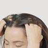 AROMASE Herbal Scalp Care Spray, ideal for dry scalp type with thinning hair, dandruff, hair loss, and sensitive scalp (4.06 Fl. Oz) view 3