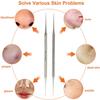 YNR Blackhead Remover Tool Whitehead Pimple Extractor Acne Comedone Spot Popper Tool view 2