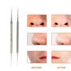 YNR Blackhead Remover Tool Whitehead Pimple Extractor Acne Comedone Spot Popper Tool view 4