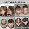 THICK FIBER Hair Fibers for Thinning Hair & Bald spots (DARK BROWN, Pack of 2) - 25g Bottle - Conceals Hair Loss in Seconds - Hair Powder For Women & Men view 4
