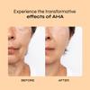 A-Cute Derm Ultra 10 AHA Anti-Aging Lotion for Exfoliation Simple and Effective for Face and Body (4 OZ) view 4