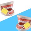 100 Pcs Disposable Mouth Swabs Sponge, BVN Oral Swabs, Oral Care Swabs Disposable, Mouth Swabs, Unflavored and Sterile Disposable Dental Swabsticks for Mouth Cleaning, Sawtooth-Shaped Yellow. view 3