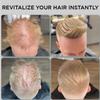 THICK FIBER Hair Fibers for Thinning Hair & Bald spots (MEDIUM BLONDE) - 25g Bottle - Conceals Hair Loss in Seconds - Hair Powder for Women & Men view 2