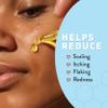 Psoriasis Honey Nourishing Scalp & Skin Serum - Dry Oil for Skin - Full Body Non Comedogenic Moisturizer Daily Dry Scalp Oil - Helps Psoriasis, Eczema, & More (1Oz) view 3