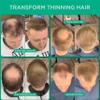 THICK FIBER Hair Building Fibers for Bald Spots & Thinning Hair (LIGHT BROWN, Pack of 3) - 25g Bottle - Conceals Hair Loss in Seconds - Hair Fibers for Men & Women view 2