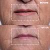 Wrinkles Schminkles Mouth & Lip Wrinkle Patch, 1-Pack, Reusable Hypoallergenic Silicone Smoothing Pads for Lip Wrinkle Prevention view 3
