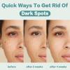 CITYGOO Dark Spot Remover for Face: Dark Spot Corrector Cream - Enriching Skin Care For All Skin Tones - Melasma Freckle Sun Spot Remover & Blemish Reducer-1.7 FL OZ view 3
