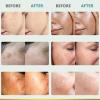CITYGOO Dark Spot Remover for Face: Dark Spot Corrector Cream - Enriching Skin Care For All Skin Tones - Melasma Freckle Sun Spot Remover & Blemish Reducer-1.7 FL OZ view 4