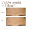 Iroha Nature - Smoothing & Hydrating 100% biodegradable sheet mask with Bakuchiol view 4