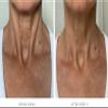 City Beauty Ultra-Firming Dry Oil - Neck & Dcolletage Treatment - Hydrate & Lift - Solution for Crepey Skin, Sagging, & Wrinkles - Non-Greasy Formula - Anti-Aging Cruelty-Free Skin Care view 2