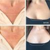 Dermaclara Silicone Chest Wrinkle Patch - Silicone Chest Patches for Wrinkles, Reusable Overnight Scar Treatment for Pregnancy, Stretch Marks, Skin Repair, Up to 30 Uses - 1 Decollete Pad view 3