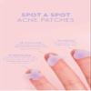 Acne Spot Patches by Florence by Mills Beauty view 3