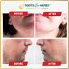 Chickpea & Kasturi Turmeric Facial Hair Removal Powder - For Men & Women, Chin, Jawline & Upper Lips - Depilatory Mask with Ayurvedic Herbs - Roots & Herbs, 2.11oz view 4