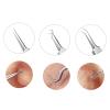 3Pcs Acne Blackheads Tweezers Stainless Steel Blemish Pimples Removers Acne Whitehead Extractor Tool for Forehead Nose Facial Pore view 4