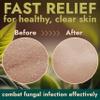 Antifungal Body Wash with Tea Tree Oil | Antibacterial Soap for Back Acne,Treats Ringworm, Eczema & Jock Itch | Antibacterial Body Soap For Men And Women | Includes Silicon Scrubber (16.9 oz) view 4