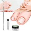 Depslee Ingrown Toenail Corrector Strips, Silicone Nail Pads Kit, painless toenail patch professional toenail treatment tool, improve the ingrown toenail (50 PIECE NAIL PADS SET) view 2