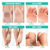 Lavinso Foot Peel Mask for Dry Cracked Feet  4 Pack Peeling Mask Removes Dead Skin and Calluses - Exfoliating for Soft Baby Feet, Original Scent view 3
