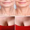 PHCOMRICH 2 PACKS Chest wrinkle pads, 100% Medical Grade Silicone Decollette Pads for Prevent and Eliminate Chest Wrinkles Anti-Aging Pads Women view 3