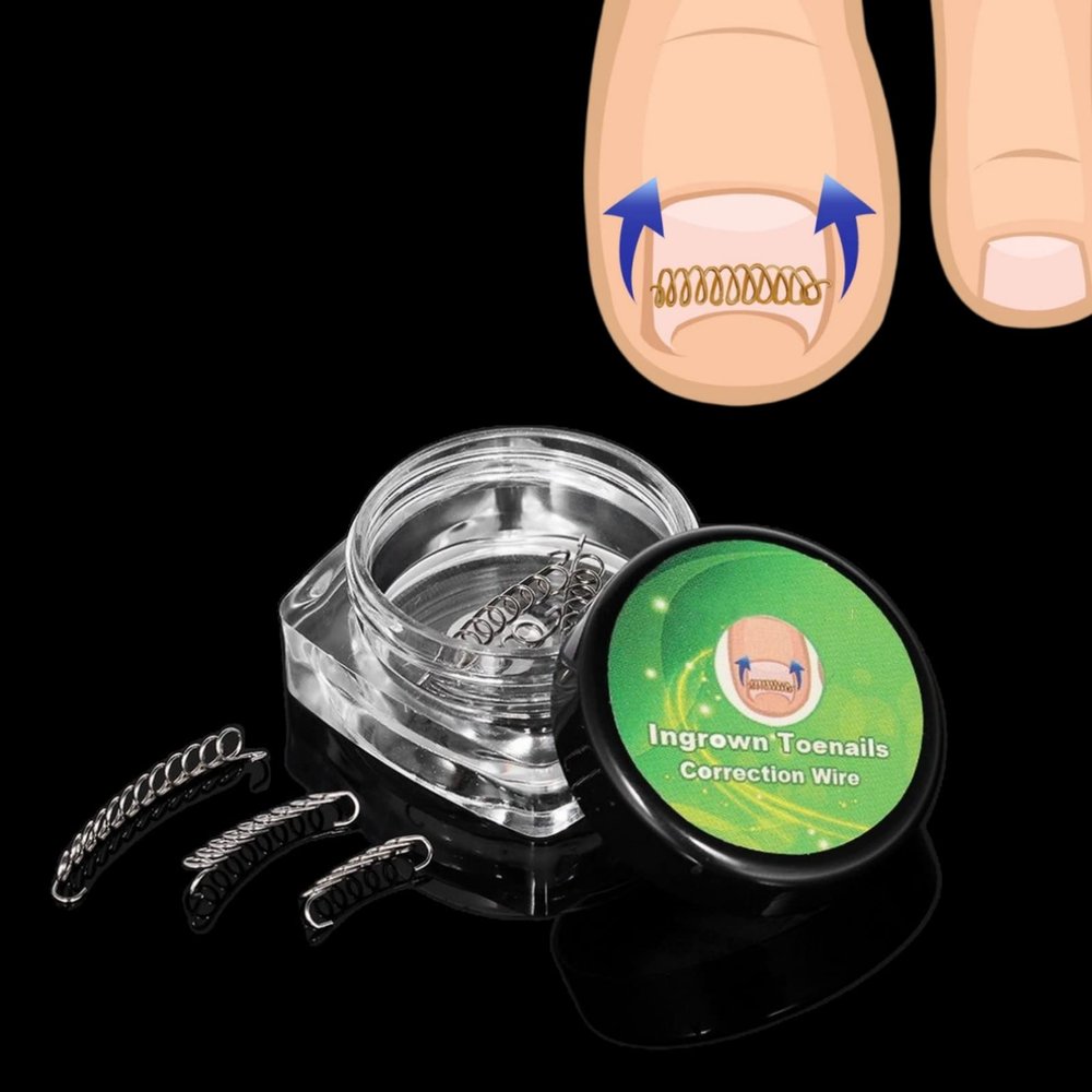 FILFEEL 6pcs Nail Ingrowing Corrector, Nail Corrector Wire, Toenail Correction Pedicure Tool, Ingrown Toenail Wire Fixer Stainless Steel Pedicure Tools for Toenail Recover, Wholesale Business