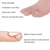 (50 +2) Pack Professional Ingrown Toenail Correction Treatment Kit, 50 Pcs Ingrown Toenail Corrector Straightener Strips Recover Clips with 2 Pcs Ingrown Toenail File And Lifter view 3