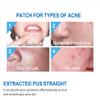 Acne pimple patch skin care Hydrocolloid acne absorbing cover patches Invisible dot Acne pimple patches Absorbing Cover, 108pcs patches view 2