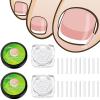 100 Pieces Ingrown Toenail Corrector Strips Toenail Correction Patches Curved Toenails Straightening Recover Clips Toenail Straightener Strip for Men Women Foot Care view 1
