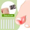 100 Pieces Ingrown Toenail Corrector Strips Toenail Correction Patches Curved Toenails Straightening Recover Clips Toenail Straightener Strip for Men Women Foot Care view 2