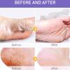 Foot Care Mask view 3