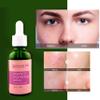 Genovie MD Vitamin C Brightening Serum For Face - Made with Anti Aging Properties, Hyaluronic Acid, Vitamin C - Facial Serum for Dark Spots, Fine Lines, Discoloration, and Wrinkles, 1 fl oz view 4