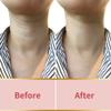Amarme Silicone Anti-Wrinkle Pads For Neck - Comfortable Fit On The Neck Overnight Use - Hydrating Effect view 2