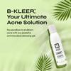 A-Cute Derm B-Kleer Cleansing Gel Acne Cleanser that Purify and Protect Your Skin from Clogged Pores for All Skin Types (4oz) view 2
