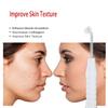 High Frequency Facial Wand/Machine with 5 Argon Parts Skin Care Tool for Wrinkles Reducing Face Skin Tightening. view 3