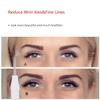 High Frequency Facial Wand/Machine with 5 Argon Parts Skin Care Tool for Wrinkles Reducing Face Skin Tightening. view 4