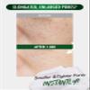 [K-Beauty] Neogen Dermalogy Pore Zero Peeling Mousse | All-in-One Foaming Exfoliating Face Wash Visibly Firming, Tightening & Lifting Skin 3.38 fl oz view 3