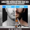 Beard Growth Kit - Oil, Balm, Serum, Derma Roller & Wooden Comb for Beard & Mustache Growth view 3