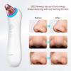 GERY Blackhead Remover Vacuum Pore Extractor Black Head Remover for Face Blackhead Extractor Pore Vacuum Pimple Extractor Skin Tag Remover Tool Pore Cleaner with Red&blue light 3 Modes 4 Suction Heads view 2