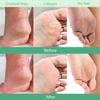 PLANTIFIQUE Foot Peeling Mask - Peeling Foot Mask Dermatologically Tested Repairs Heels & Removes Dry Dead Skin for Baby Soft Feet (Jasmine, 1 Count (Pack of 1)) view 4
