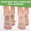 Activelife - Urea Cream 40 Percent for Feet, Formulated by Doctors, Foot Cream for Dry Cracked Heels, Foot Callus Remover, Rehydrates Dry, Rough, Dead Skin on the Feet, Hands, and Elbows, Free Pumice view 2
