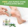 Activelife - Urea Cream 40 Percent for Feet, Formulated by Doctors, Foot Cream for Dry Cracked Heels, Foot Callus Remover, Rehydrates Dry, Rough, Dead Skin on the Feet, Hands, and Elbows, Free Pumice view 3