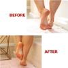 Kerasal Intensive Foot Repair Skin Healing Ointment, 1 Oz and Moisturizing Gel Socks, One Pair (Packaging May Vary) view 4