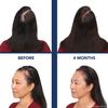 Bosley Revitalizer Flex 164 Diode 100% Laser No LEDs Hair Growth Cap (LLLT) Men and Women - Regrowth, Home Treatment, Thicker, Fuller, Healthy Hair, FDA Cleared. Large Size view 3
