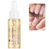 7 Days Nail Growth And Strengthening Serum 20ml Onychomycosis Softening Solution Nails Treatment Oil for Discolored And Damaged Nails view 2