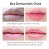 20Pcs Moisturizing/Plumping Lip Mask, Restores Moisture Mask for Dry Lips and Lines Overnight Care, Gel Treatment Masks  (Pink) view 3