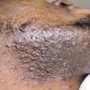 CWHaircare Black Beard beard elixir is an all natural beard growth product that conditions, softens, grows, helps to prevent razor bumps, also adds a beautiful healthy shine and it smells AMAZING!!! view 3
