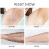 EwaCCen Women's Electric Shaver Replacement Heads : 5 Legs Hair Removal Razor Replacement Heads 4D Floating Heads Replacement Blades for Women view 4