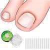 (30+2) Pack Ingrown Toenail Correction Treatment Kit, 30PCS Ingrown Toenails Corrector Strips Brace Ingrown Toenail Pedicure Tool Toenail Correction Patch with 2PCS Ingrown Toenails Lifter and File view 3