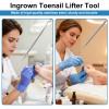 (30+2) Pack Ingrown Toenail Correction Treatment Kit, 30PCS Ingrown Toenails Corrector Strips Brace Ingrown Toenail Pedicure Tool Toenail Correction Patch with 2PCS Ingrown Toenails Lifter and File view 4